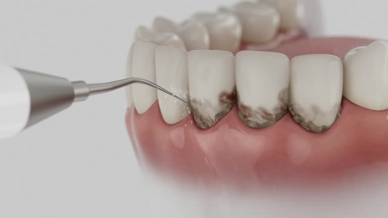 Trusted Teeth Cleaning And Checkup service in Santa Clara, CA - Dentist Open Now